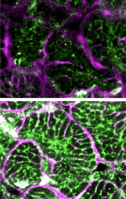 Terapie genică promițătoare ar putea transforma tratamentul insuficienței cardiace