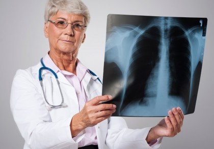 Decesele cauzate de cancerul pulmonar scad la nivel global, dar factorii de risc persistă