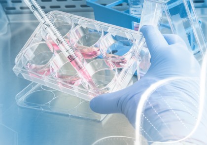 Proteinele inflamazomului previn cancerul prin reglarea celulelor stem