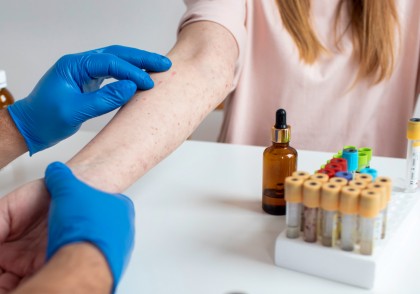 Inflamația intestinală ar putea explica problemele gastrointestinale la pacienții cu psoriazis