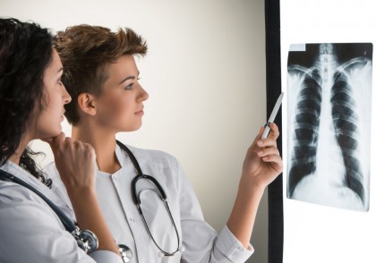 Fibroza pulmonară post-COVID-19 - prognostic mai bun decât cea idiopatică