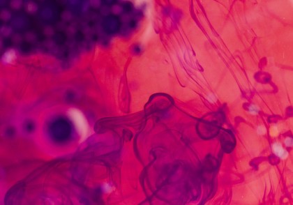 În sepsis celulele pe moarte declanșează o reacție letală în lanț