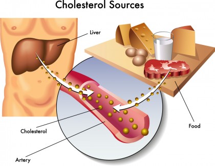 O singură injecție pentru a scădea colesterolul pe viață? Oamenii de știință deblochează o terapie genetică revoluționară