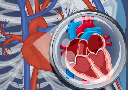 Un nou medicament (ataciguat) ar putea reduce necesitatea intervențiilor chirurgicale pentru stenoza valvei aortice