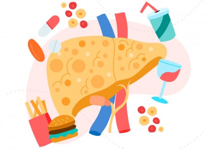 Acidul ursolic ameliorează inflamația în boala hepatică steatozică prin reglarea conversiei estrogenilor