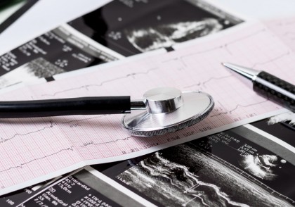 Prezența micro- și nanoplasticelor în plăcile de aterom, asociată cu risc crescut de AVC