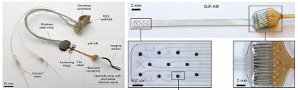Implant auditiv cerebral moale pentru restabilirea auzului: o nouă generație de neuroproteze testată cu succes la primate