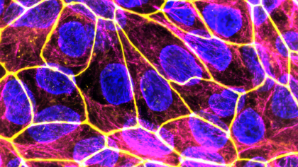 Nanozimele terapeutice: potențial biomedical promițător și provocări viitoare în evaluarea toxicologică