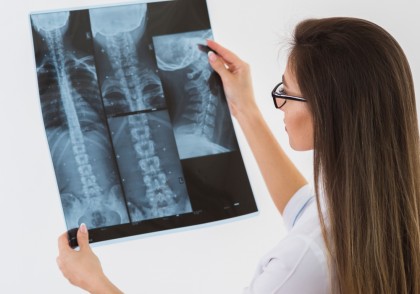 Stimularea nervului vag în buclă închisă (CLV): O nouă terapie promițătoare pentru recuperarea funcției membrelor superioare după leziuni medulare