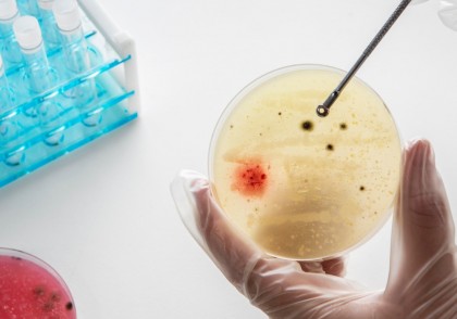 Tulpinile pandemice de holeră din America Latină posedă sisteme complexe de apărare anti-fagică