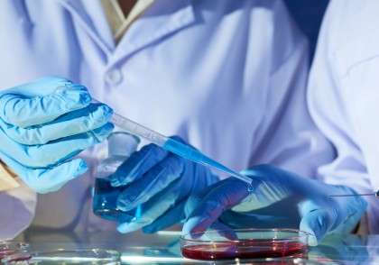 Restaurarea glicocalixului: o nouă cale terapeutică în boala Alzheimer