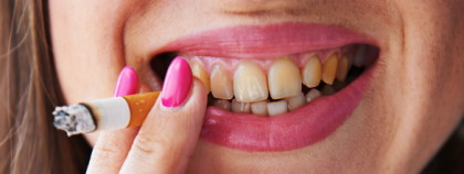 Reconstrucția istoriei fumatului prin analiza cementului dentar: Dovezi preliminare din probe moderne și arheologice