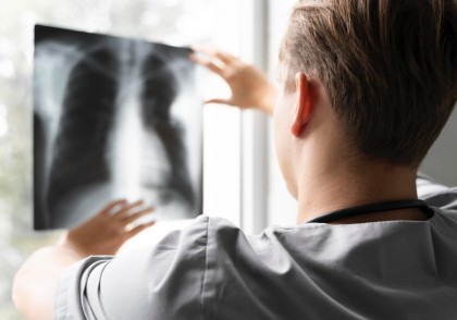 Detectarea bolii ficatului gras (steatoza hepatică) cu ajutorul radiografiilor toracice și al unui model AI: un pas înainte în diagnosticarea precoce