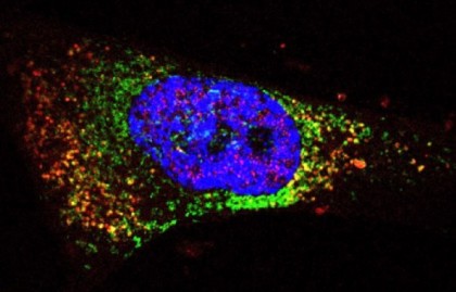 Noi perspective în tratamentul inflamației cronice: rolul proteinei WSTF