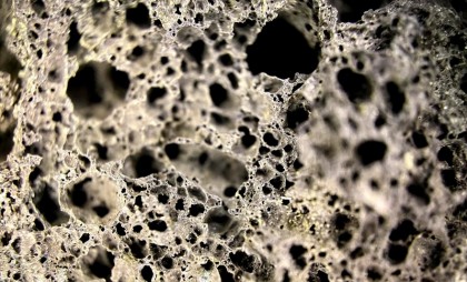 Estimarea densității minerale osoase cu ajutorul inteligenței artificiale din radiografii lombare anteroposterioare