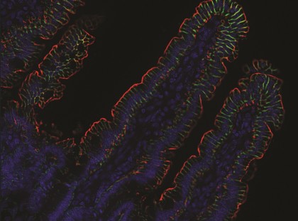 Noi descoperiri despre modul în care sistemul imunitar combate paraziții intestinali