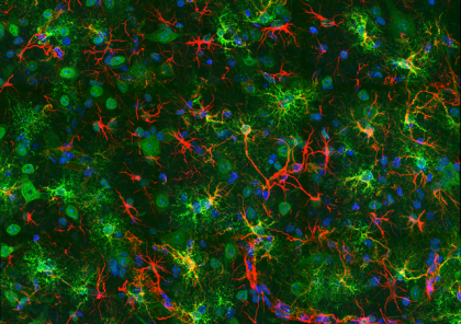 Mediul sărac în oxigen protejează creierul și restabilește mișcarea la șoarecii cu Parkinson