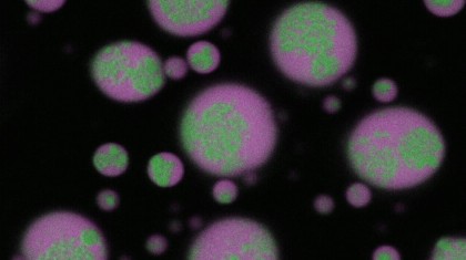 O descoperire majoră: Cum pot fi prevenite și dizolvate aglomerările de ARN din celulele cerebrale