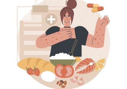 Alergeni alimentari responsabili de anafilaxie severă: patru noi alimente propuse pentru etichetare obligatorie în Uniunea Europeană