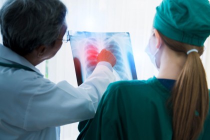 Un instrument bazat pe inteligență artificială evidențiază conexiunile dintre fibroza pulmonară și procesul de îmbătrânire