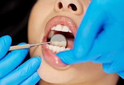 Gingiile sănătoase înseamnă dinți sănătoși