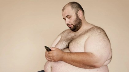 Obezitatea severă se asociază cu o frecvență redusă a screening-urilor recomandate pentru cancer