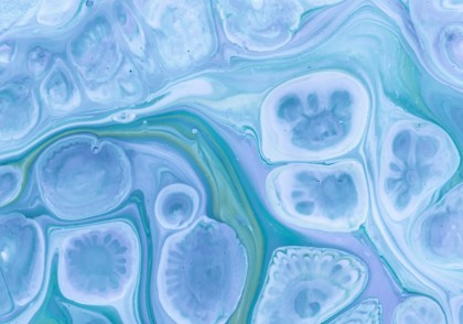 Comportament asemănător demenței în celulele pancreatice precanceroase: indicii pentru prevenția cancerului pancreatic