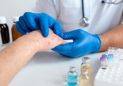 Onamidele din buretele marin Theonella sp. – candidați promițători pentru tratamentul leishmaniozei