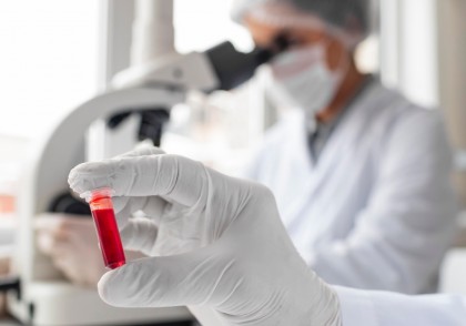 Un test simplu de sânge pentru predicția bolilor hepatice severe: modelul CORE validat la scară populațională