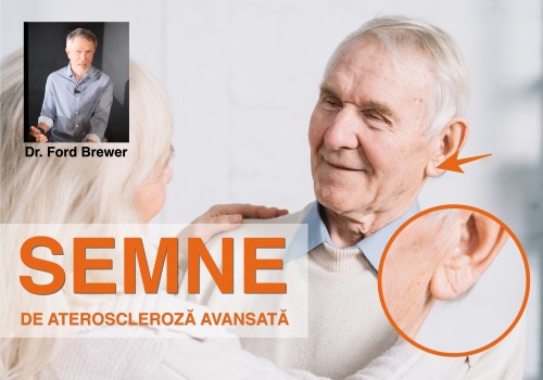 Cele 5 semne silențioase ale arterelor înfundate pe care nu trebuie să le ignori