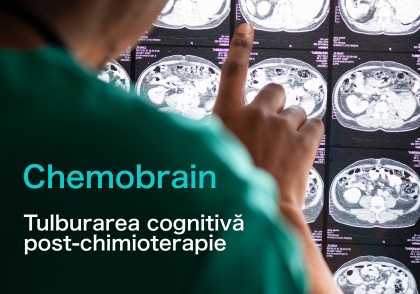 Tulburarea cognitivă post-chimioterapie (chemobrain)