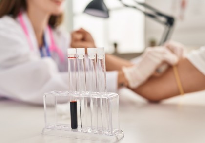 Un nou mecanism molecular care explică sensibilitatea crescută a sarcomului Ewing la medicamentele ce inhibă topoizomeraza I (TOP1), cum este irinotecanul