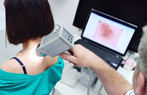 Dermatoscopia digitală: importanța în diagnosticul precoce al cancerului cutanat