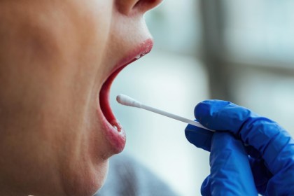 Microbiomul oral al persoanelor cu scleroză multiplă prezintă semne de disbioză