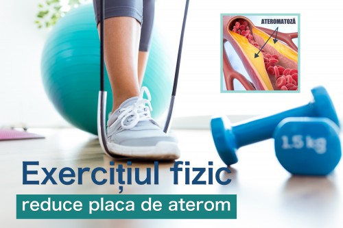 Exercițiul fizic reduce placa de aterom - mecanisme