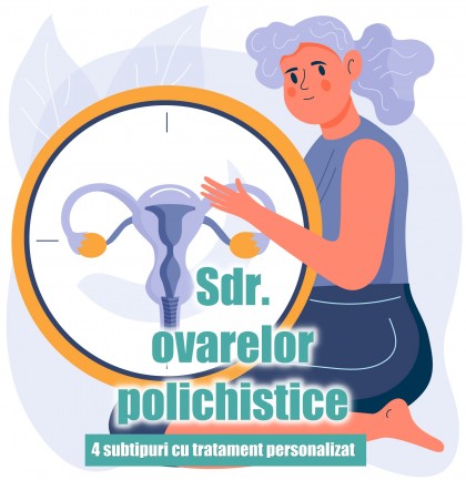 4 subtipuri ale sindromului ovarelor polichistice și implicațiile lor clinice