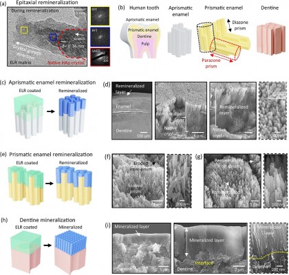 Gel pe bază de proteine pentru regenerarea funcțională a smalțului dentar