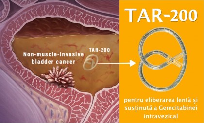 TAR-200: prima terapie intravezicală cu eficacitate dovedită în cancerul vezical cu risc crescut refractar la BCG