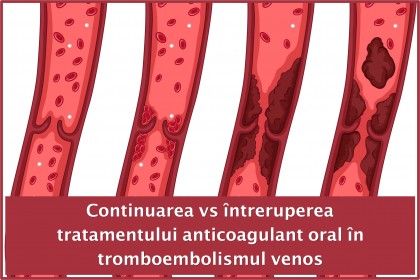 Continuarea versus întreruperea tratamentului anticoagulant oral în tromboembolismul venos