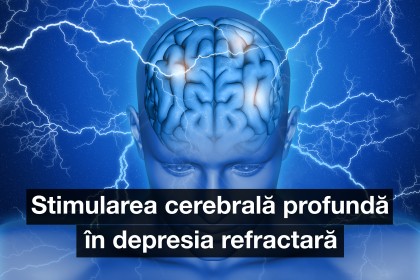 Stimularea cerebrală profundă în depresia refractară
