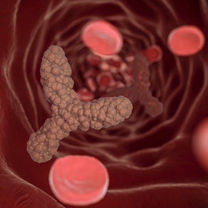 Terapia cu celule T modificate genetic ar putea deveni o strategie eficientă pentru prevenirea aterosclerozei