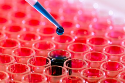 Corectarea disfuncției lizozomale reactivează potențialul stem al celulelor hematopoietice îmbătrânite