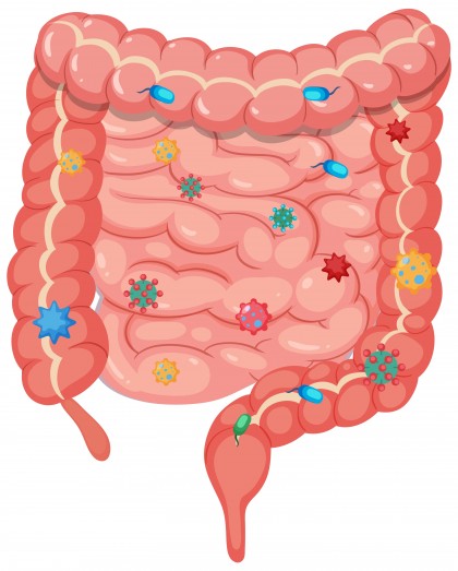 Legătura dintre obezitate, microbiomul intestinal și cancerul colorectal