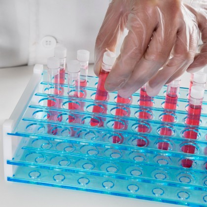 Test rapid pentru diferențierea infecțiilor reale cu virusul imunodeficienței umane de rezultatele fals pozitive induse de vaccinurile experimentale