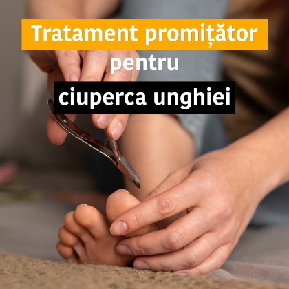 Potențialul terapeutic al hidrogenului sulfurat în onicomicoză (ciuperca unghiei)