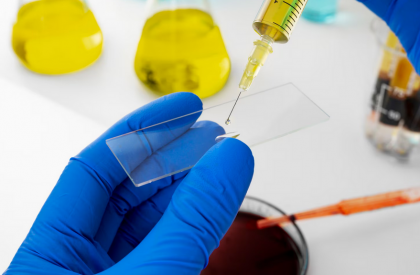 Biopsiile lichide pot accelera diagnosticul și ghidarea tratamentului la pacienți cu cancer pulmonar non-microcelular