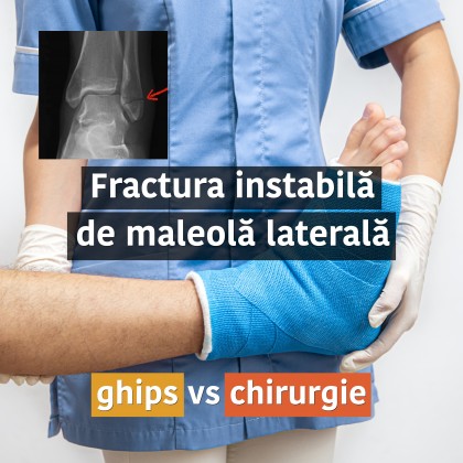 Imobilizare în ghips versus chirurgie pentru fracturile instabile de maleolă laterală (Weber B)