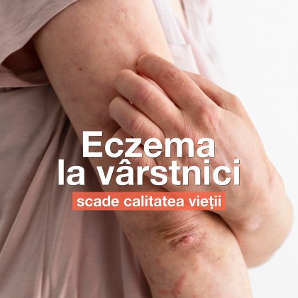 Efectele eczemei asupra calității vieții la vârstnici