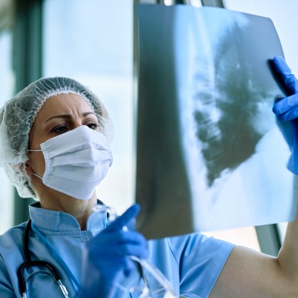 Impactul nirsevimab asupra spitalizărilor prin bronșiolită la sugari