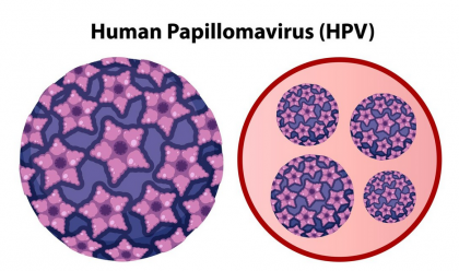 Configurația antigenică a nanovaccinurilor bazate pe acizi nucleici sferici determină răspunsul imun antitumoral în carcinomul scuamos de cap și gât asociat HPV